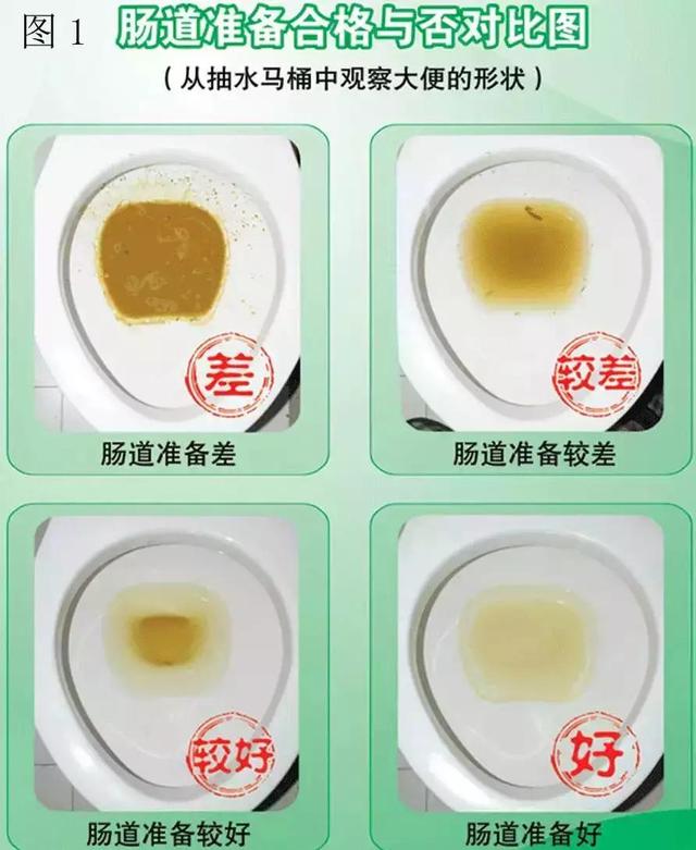 南寧潰瘍性結腸炎到哪個(gè)醫院治