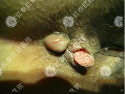 南寧肛腸醫院